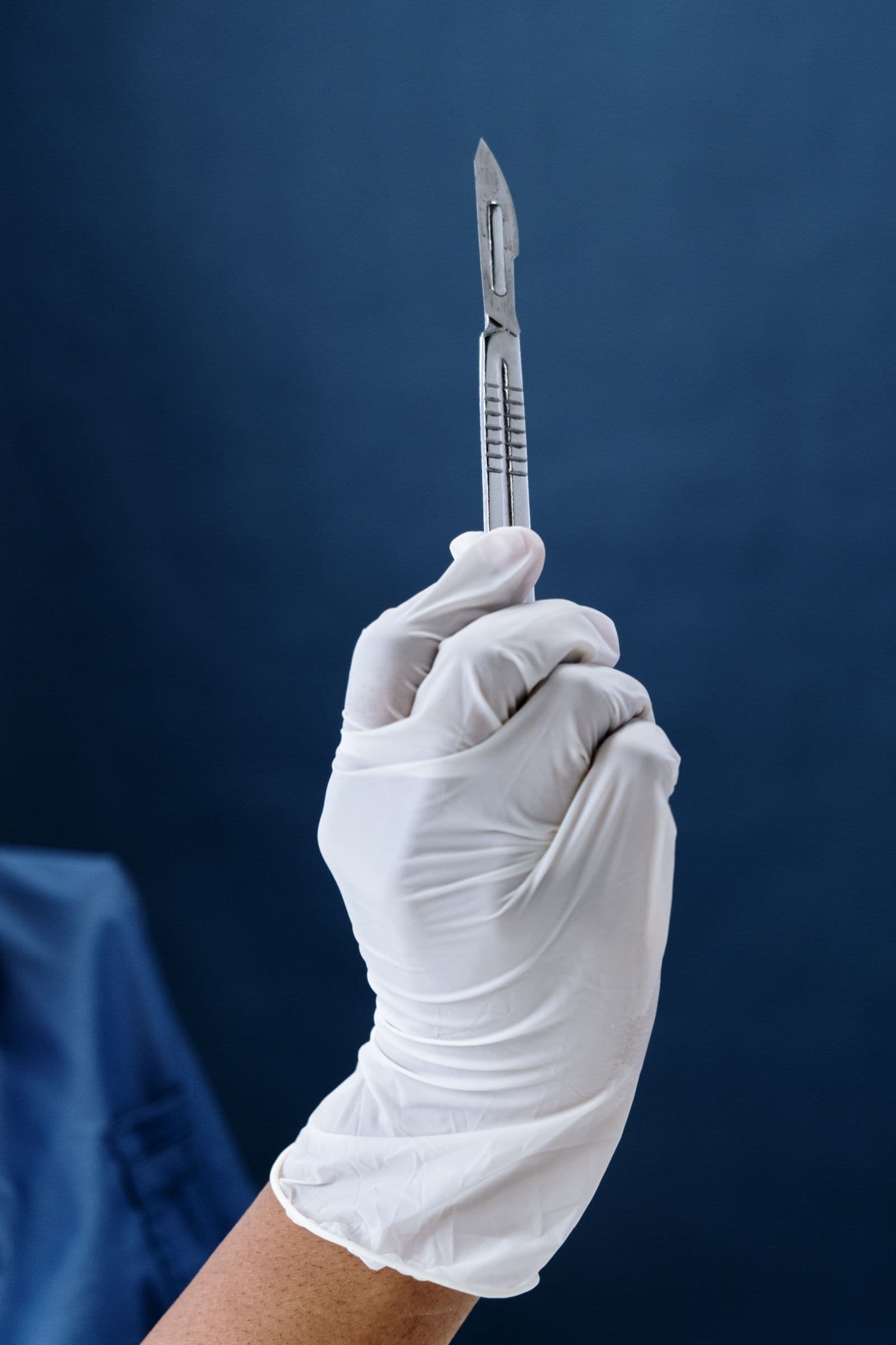 Blutegeltherapie bei venöser Stauung: Zeit für gefährdetes Gewebe